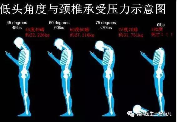 颈椎病健康科普短视频,颈椎病疾病科普