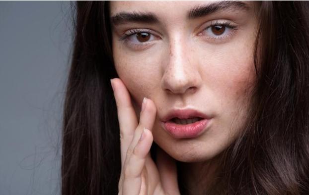 脸上色素沉着斑多暗黄怎么办,脸上斑点暗黄越来越多是什么原因