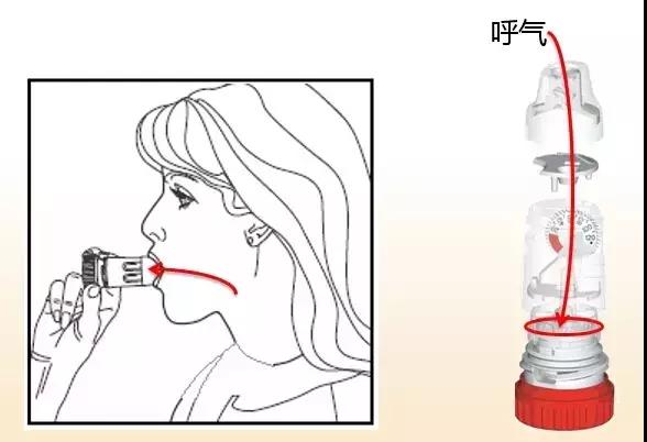 药师教你怎样使用吸入剂,如何指导患者使用吸入剂