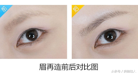 眉形改造系列,眉形改造眉形设计