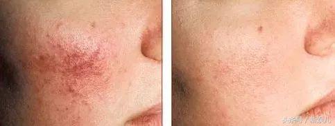 为什么范冰冰比林允气质好,范冰冰王菲谁漂亮