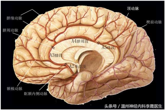 张景明教授讲脑中风后遗症,李医生讲中风视频全集