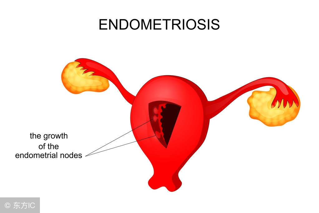 宫颈炎常见两种病原体,宫颈炎性疾病怎么预防
