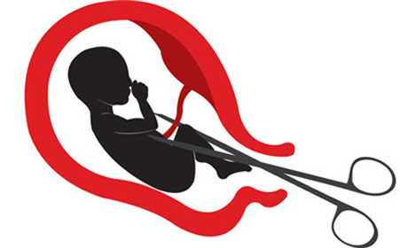 人流是什么样的感受,一个人去做了人流后的感悟