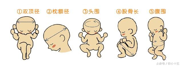 怀孕三个月彩超怎么看数值,怀孕三周怎么测出来