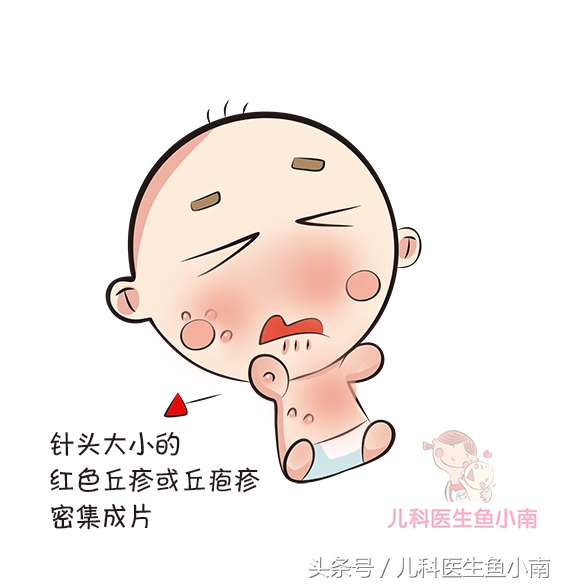 宝宝湿疹不红了但还有小疙瘩痒,宝宝湿疹和热疹的正确护理方法