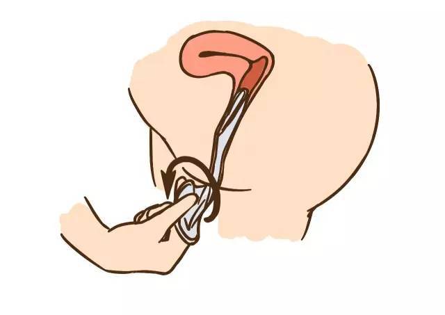 你该知道的小姿势，关于不想意外要孩子的一些运动