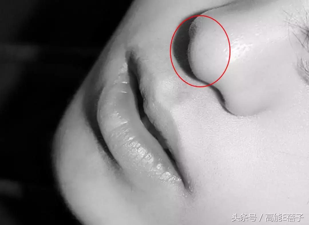 别傻了！蔡徐坤、Angelababy都根治不掉的黑头，微商神器能去除？