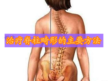 治疗脊柱畸形的主要方法有什么