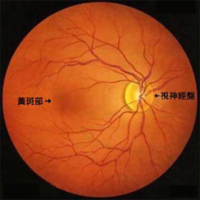 视神经脊髓炎的注意事项有哪些,视神经脊髓炎的治疗方法