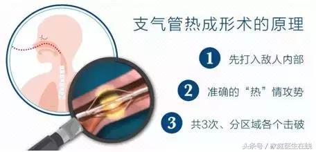 哮喘发作没有药怎么救,哮喘发作怎么治疗最好