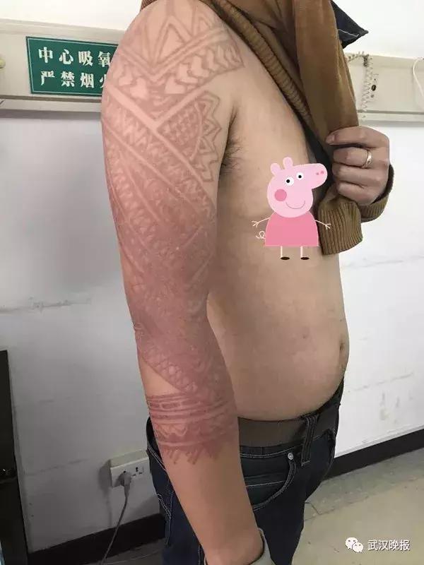 「健康」他在巴厘岛尝鲜特色服务,现在可能一辈子消不掉……悔恨啊!