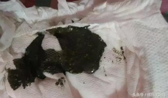 宝宝大便能判断胀不胀气,宝宝大便能看出什么