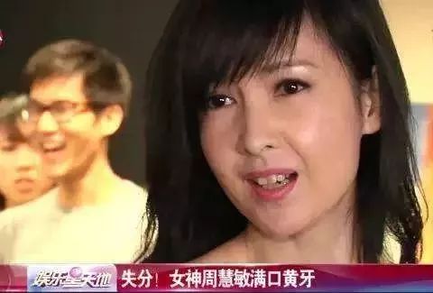 日本牙膏修复牙洞是真的吗,为什么日本人牙那么白