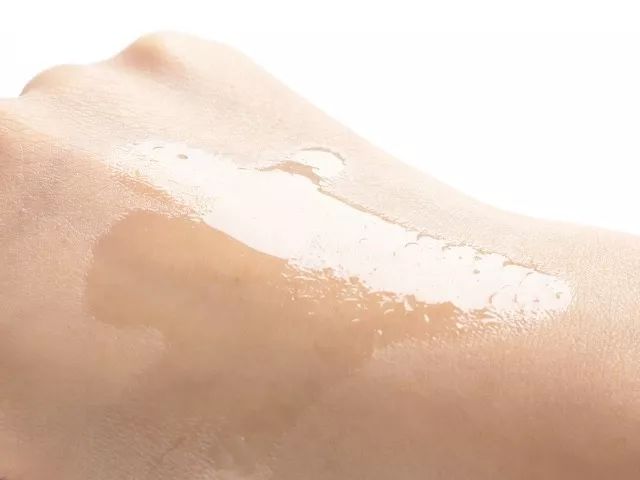 拼团｜抹了它，痘印、疤痕全都慢慢消失了