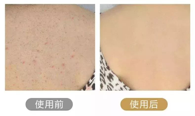 别让垃圾堵塞你的毛孔!有了这款火爆日本的沐浴刷,让你惊呼:洗澡搓背原来这么爽