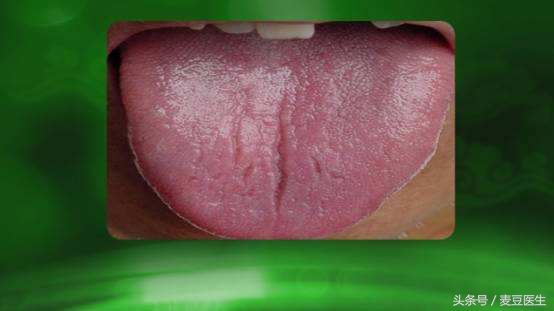 最全中医舌诊图谱来啦!看舌头,知全身!