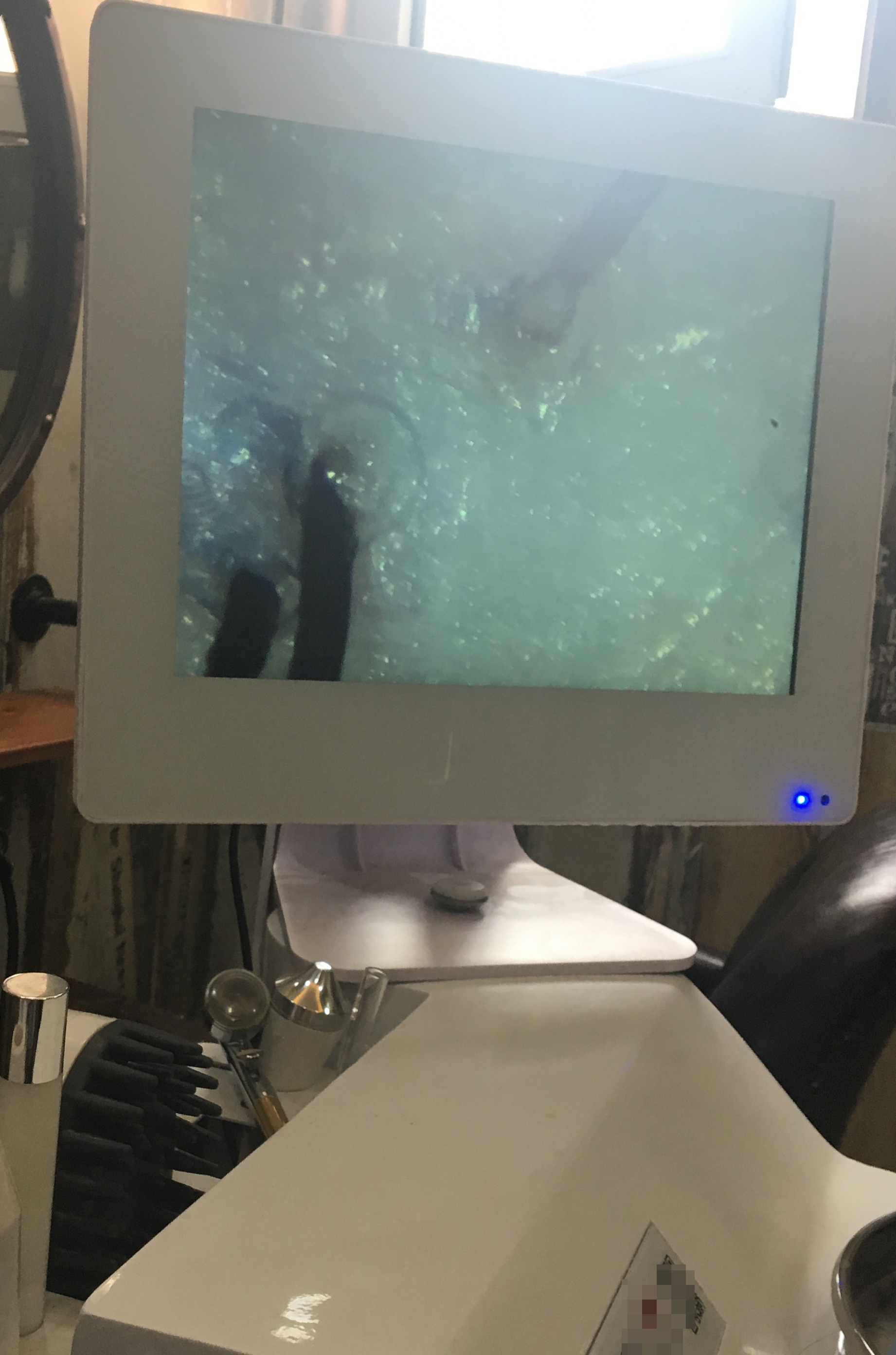 理发店头皮检测要钱吗,美发店的头皮检测去角质靠谱吗