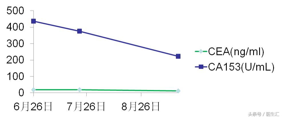 晚期乳腺癌病例,浸润性小叶乳腺癌3级