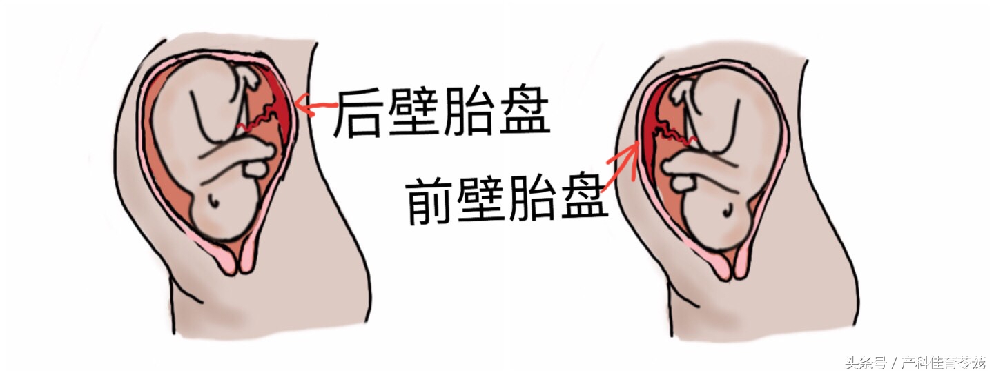 如何看懂乳腺超声检查报告,怎么能让临床医生看懂超声报告