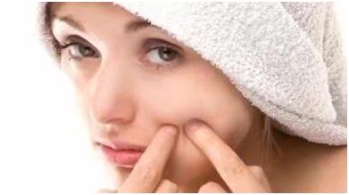 挤痘痘留了痘疤怎么办,挤痘痘留疤痕怎么消除