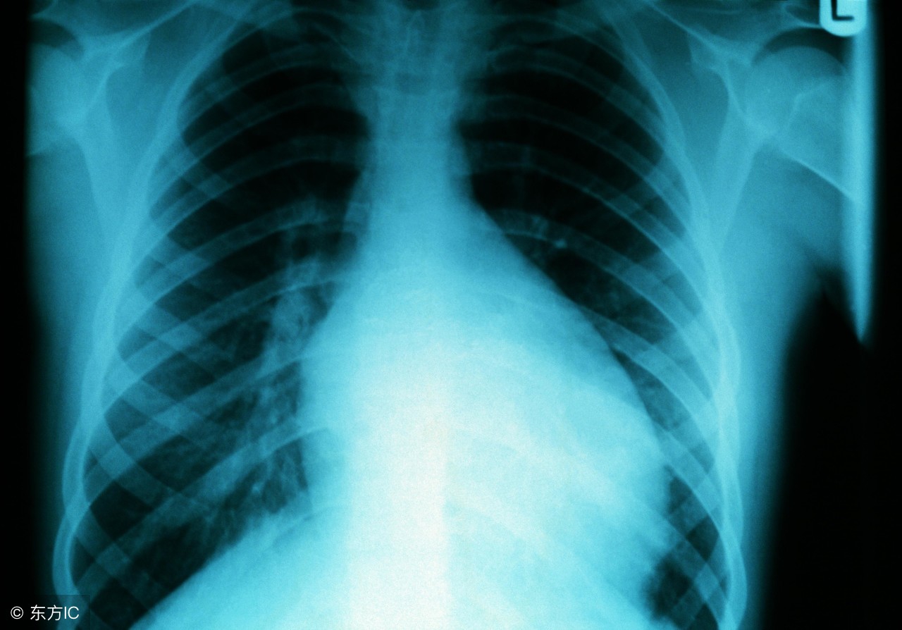 心肌炎的症状发病原因,心肌炎的症状和原因