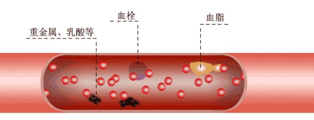 人的血管很明显是怎么回事,经常输液的人如何保养血管