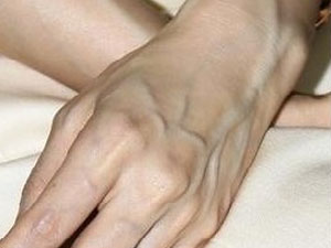 手上青筋怎么治愈呢,可以看到手上的青筋是怎么回事