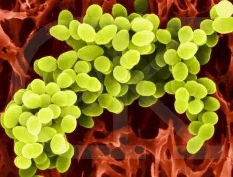 脚被鞋子磨肿了怎么办,鞋子磨脚怎么软化鞋子