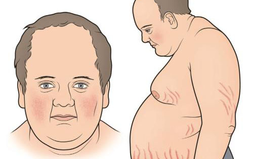 熬夜变胖是什么原因,40岁女人变胖的原因