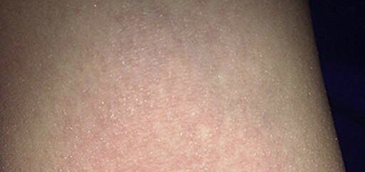 拒绝做个黄脸婆孕妇！孕产肌肤护理技巧看这里就够了