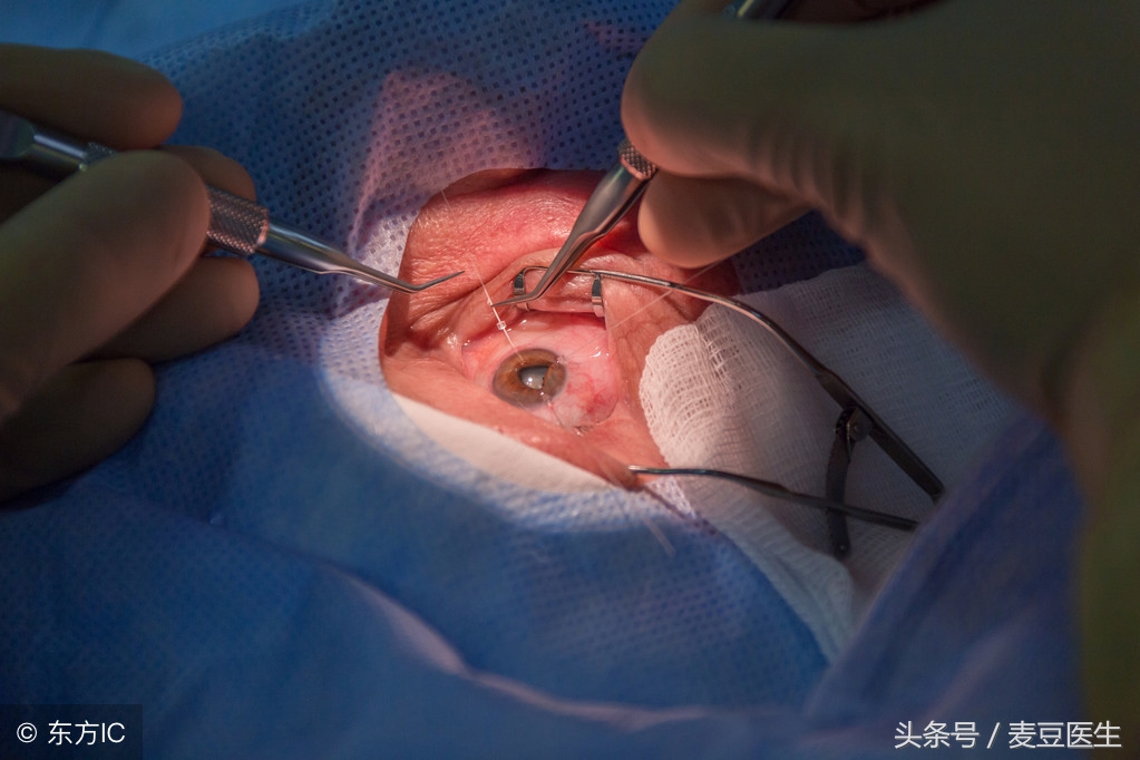 糖尿病引发的白内障最佳治疗方法,糖尿病人患有轻微白内障怎么治疗