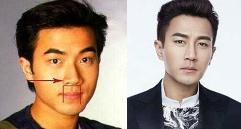 广州整形医院哪家是正规医院,国内知名整形医院