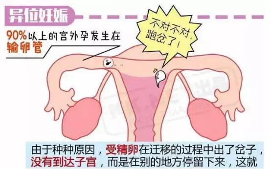 怀孕多久可以检查出是否宫外孕,怀孕多久可以去检查是否是宫外孕