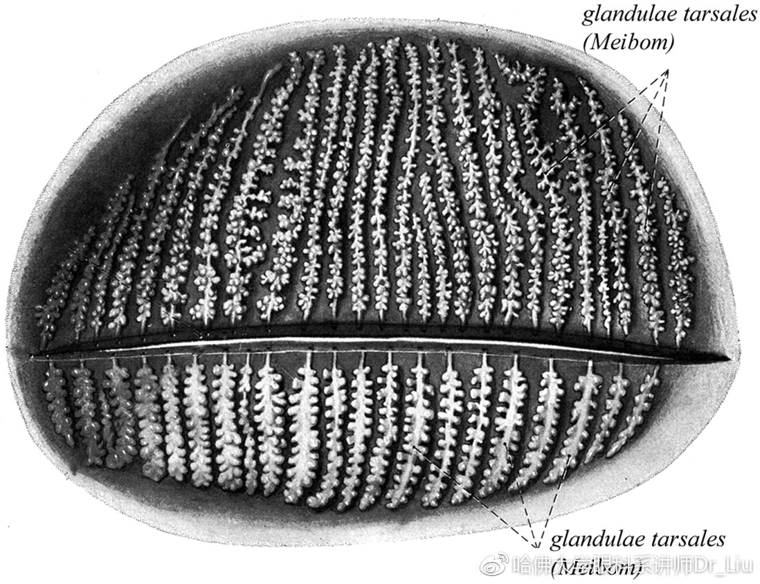 睑板腺功能障碍是干眼症吗,睑板腺功能障碍中医怎么讲