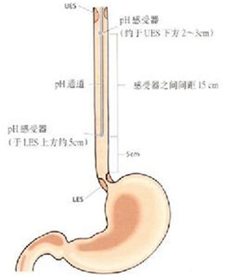 喉咙吞咽疼痛口苦口干,咽喉痛咽干口苦