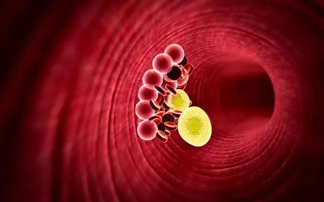 女生臀腿必练动作,练臀腿瘦得快的原因