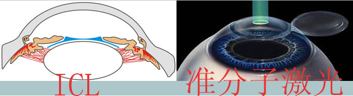 近视科普方案有哪些,近视科普教育方案