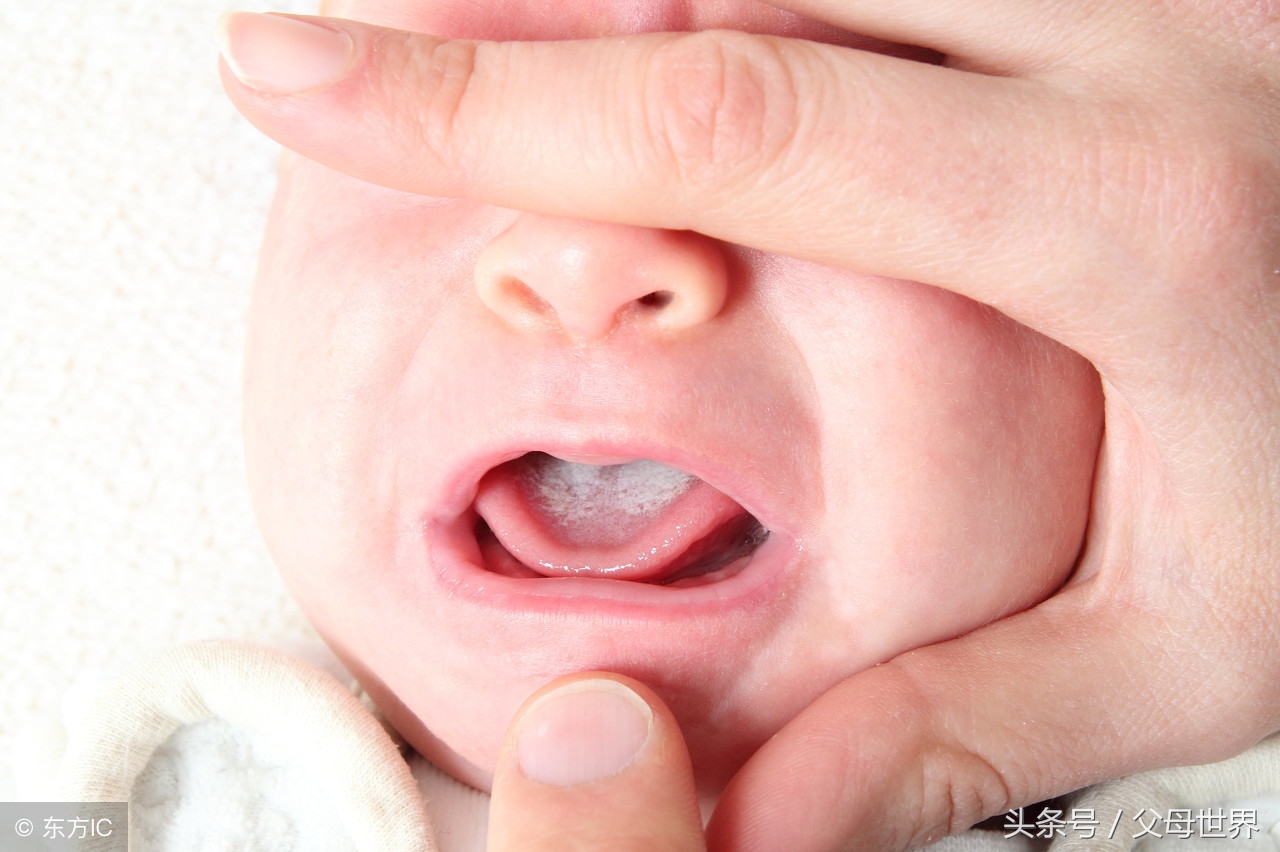 宝宝嘴里起溃疡睡不着怎么办,宝宝嘴里溃疡发烧怎么办