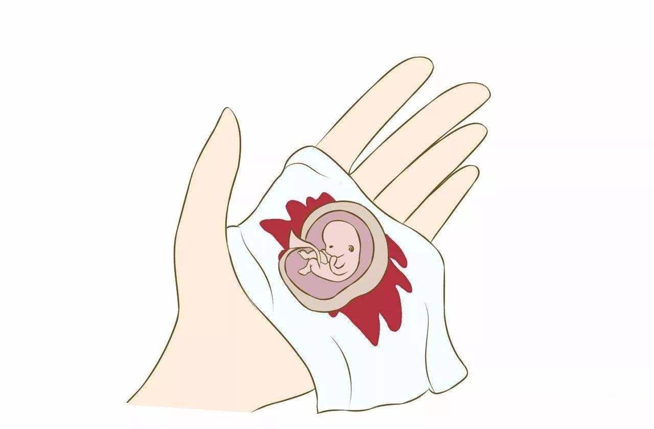 女性的一生可以承受几次流产?超过这个次数,身体就要毁了