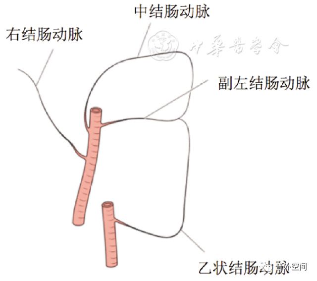 腹腔镜完整结肠系膜切除术相关血管变异与术中出血的应对措施(上)