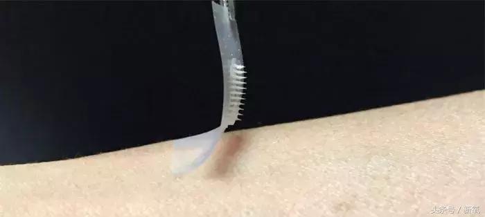 治疗痘坑的微针品牌,家用抗皱美白祛斑微针