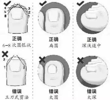 跑步脚上起血泡长什么样子,跑步大脚趾起水泡是怎么回事