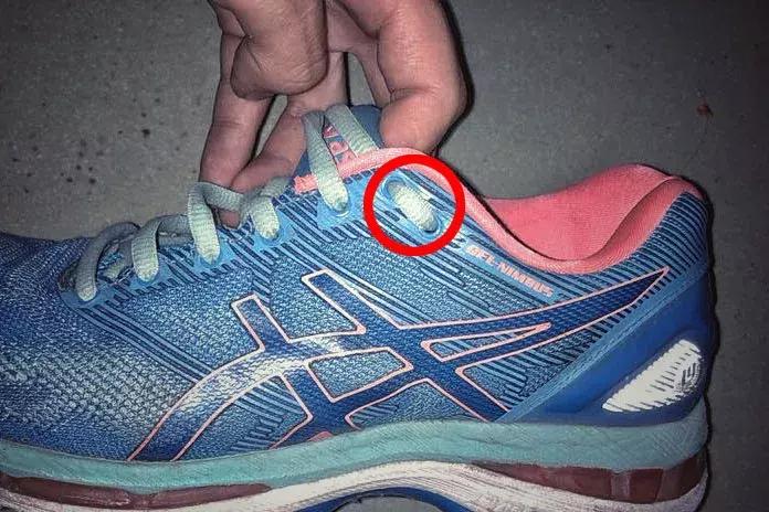 跑步跑到脚趾甲盖里面有水泡图片,跑步脚上出现黑趾甲该怎么处理