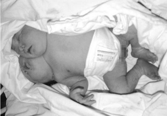 生两个女儿很开心,生两个孩子是希望他们互相陪伴