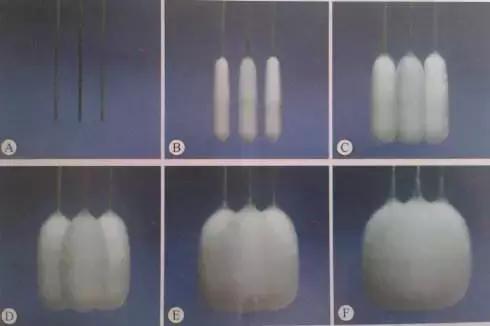 微创冷冻治疗癌症,氩氦刀冷冻消融技术治疗癌症