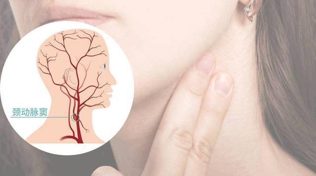 打后脑勺哪里会晕,打后脑勺哪里会让人晕过去