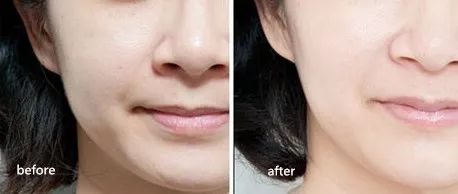 洁面吸油神器,电动洗脸神器清洁毛孔