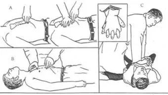 雨天触电如何急救心肺复苏,雨天触电如何急救