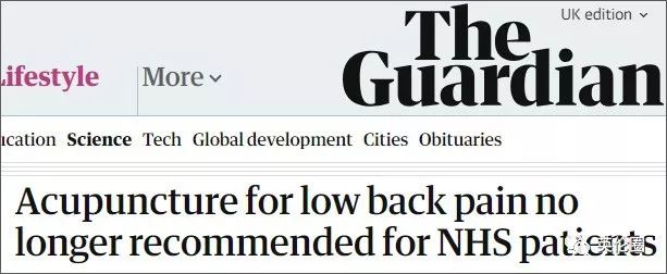 哈里梅根婚前求助中医！歪果仁已经把针灸吹上了天